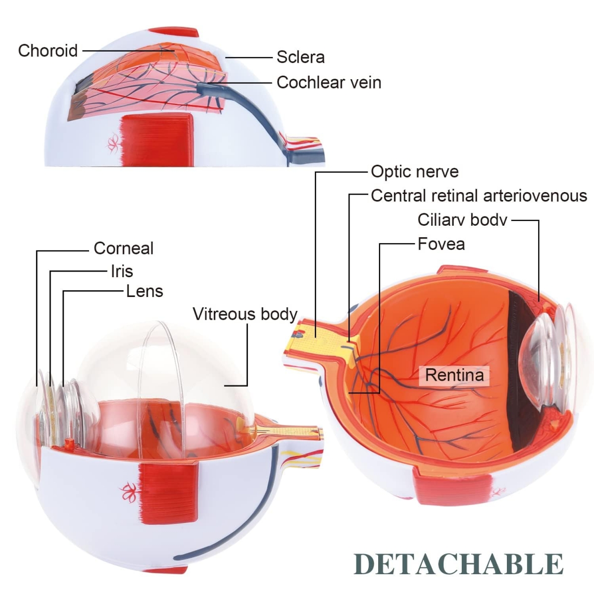 Human Eye Model Times Enlarged With Dissectible Parts Myaskro